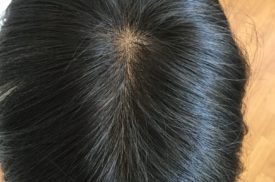 松本市 ウィッグ