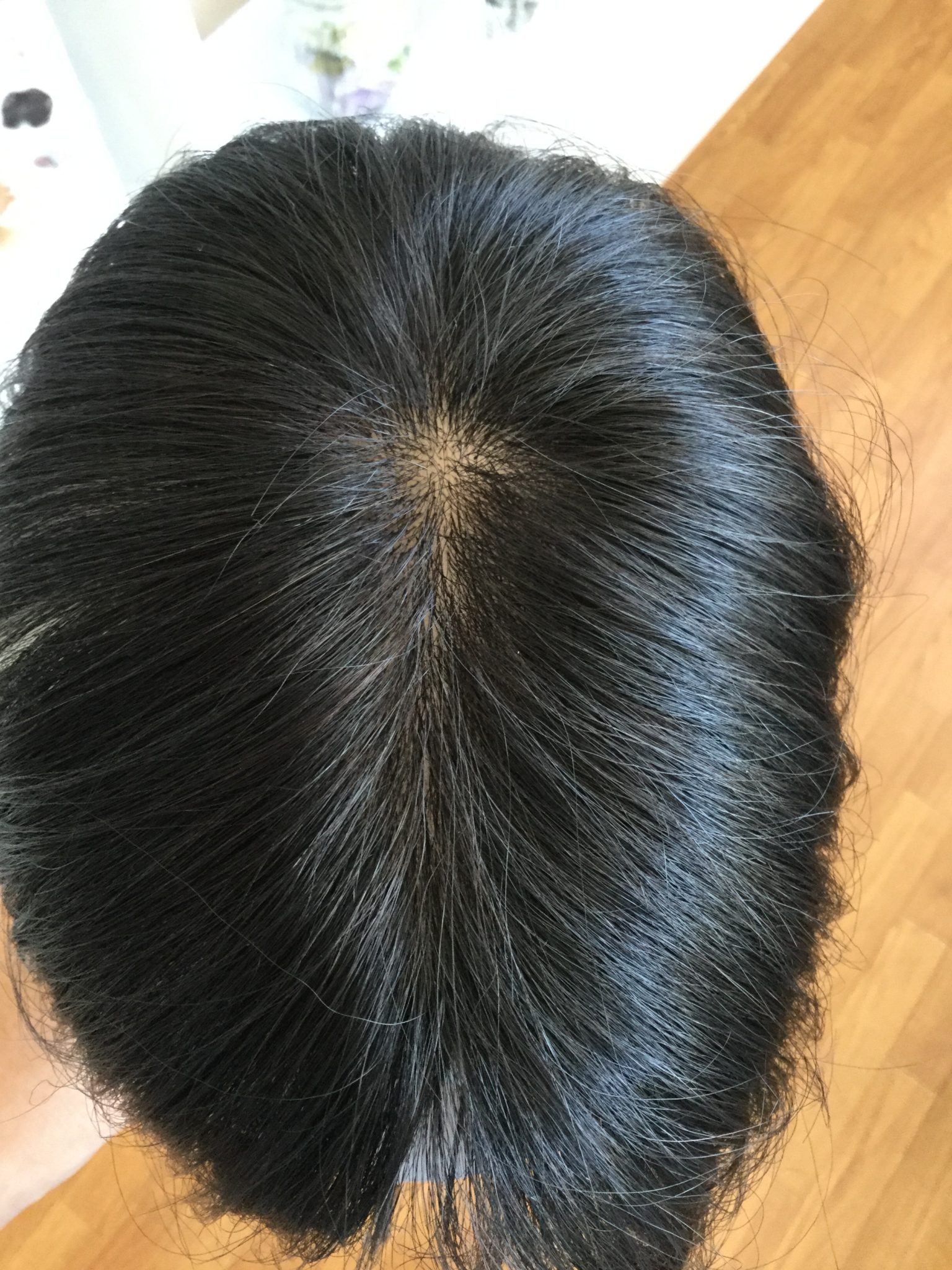 ウィッグが不自然に見えてしまう原因は 福山ウィッグ 美容師がサポートするウィッグ 増毛